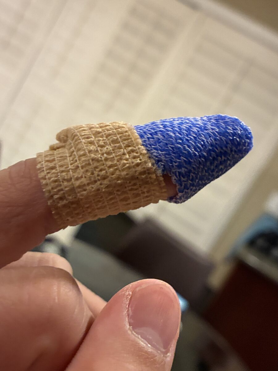 Custom hand orthosis example — thermoplastic splint made at Reach Beyond Therapy in Redondo Beach