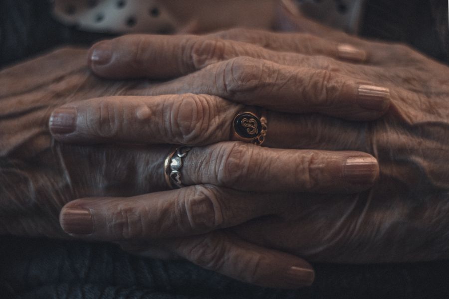 Close-up of elderly hands showing the joint changes and texture associated with hand arthritis