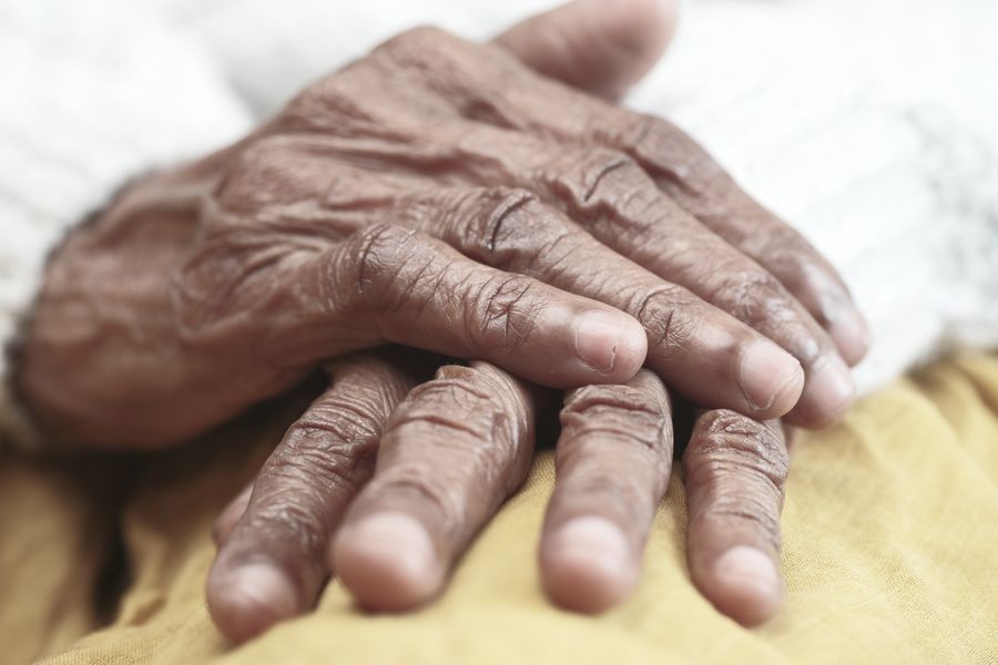 Senior adult hands at rest, showing the characteristic texture and stiffness of arthritic joints